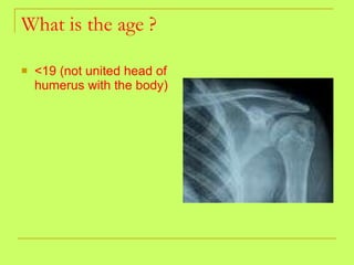 What is the age ? <19 (not united head of humerus with the body) 