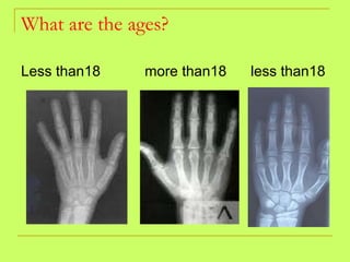 What are the ages? Less than18  more than18  less than18 