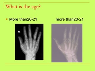 What is the age? More than20-21  more than20-21  