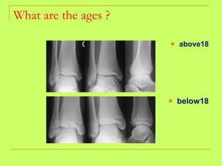 What are the ages ? above18 below18 