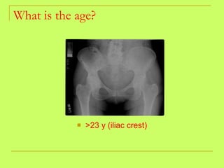 What is the age? >23 y (iliac crest) 