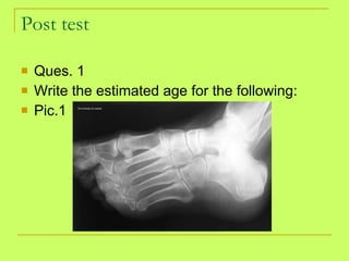 Post test Ques. 1 Write the estimated age for the following: Pic.1 