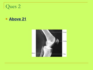 Ques 2 Above 21 