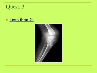 Quest. 3 Less than 21 