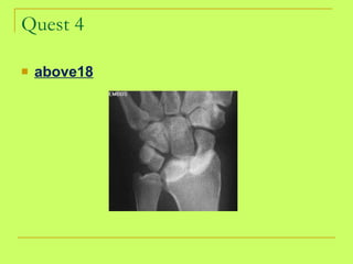 Quest 4 above18 