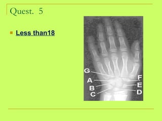 Quest.  5 Less than18 