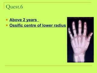 Quest.6 Above 2 years  Ossific centre of lower radius 
