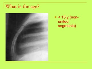 What is the age? <ul><li>< 15 y (non-united segments) </li></ul>