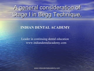A general consideration of
Stage I in Begg Technique.
INDIAN DENTAL ACADEMY
Leader in continuing dental education
www.indiandentalacademy.com

www.indiandentalacademy.com

 