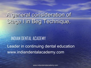 A general consideration of
Stage I in Beg Technique.
INDIAN DENTAL ACADEMY
Leader in continuing dental education
www.indiandentalacademy.com
www.indiandentalacademy.com

 