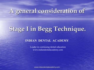 A general consideration of
Stage I in Begg Technique.
www.indiandentalacademy.com
INDIAN DENTAL ACADEMY
Leader in continuing dental education
www.indiandentalacademy.com
 