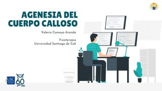 AGENESIA DEL
CUERPO CALLOSO
Valeria Camayo Aranda
Fisioterapia
Universidad Santiago de Cali
 