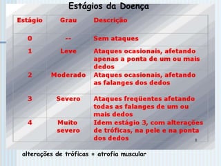alterações de tróficas = atrofia muscular
Estágios da Doença
 