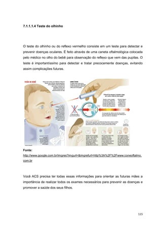 115
7.1.1.1.4 Teste do olhinho
O teste do olhinho ou do reflexo vermelho consiste em um teste para detectar e
prevenir doenças oculares. É feito através de uma caneta oftalmológica colocada
pelo médico no olho do bebê para observação do reflexo que vem das pupilas. O
teste é importantíssimo para detectar e tratar precocemente doenças, evitando
assim complicações futuras.
Fonte:
http://www.google.com.br/imgres?imgurl=&imgrefurl=http%3A%2F%2Fwww.coneoftalmo.
com.br
Você ACS precisa ter todas essas informações para orientar as futuras mães a
importância de realizar todos os exames necessários para prevenir as doenças e
promover a saúde dos seus filhos.
 