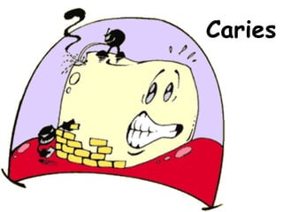 Caries 