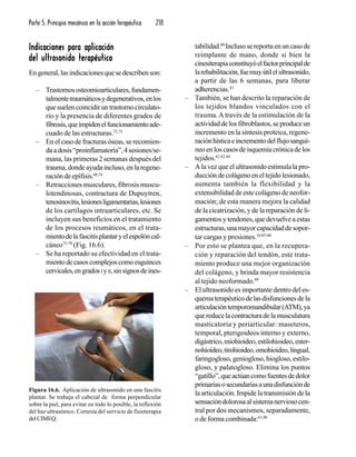 Parte 5. Principio mecánico en la acción terapéutica 218
Indicaciones para aplicaciónIndicaciones para aplicaciónIndicaciones para aplicaciónIndicaciones para aplicaciónIndicaciones para aplicación
del ultrasonido terapéuticodel ultrasonido terapéuticodel ultrasonido terapéuticodel ultrasonido terapéuticodel ultrasonido terapéutico
Engeneral,lasindicacionesquesedescribenson:
– Trastornososteomioarticulares,fundamen-
talmentetraumáticosydegenerativos,enlos
quesuelencoincidiruntrastornocirculato-
rio y la presencia de diferentes grados de
fibrosis,queimpidenelfuncionamientoade-
cuado de las estructuras.72,73
– En el caso de fracturas óseas, se recomien-
daadosis“proinflamatoria”,4sesiones/se-
mana, las primeras 2 semanas después del
trauma, donde ayuda incluso, en la regene-
ración de epífisis.60,74
– Retracciones musculares, fibrosis muscu-
lotendinosas, contractura de Dupuytren,
tenosinovitis,lesionesligamentarias,lesiones
de los cartílagos intraarticulares, etc. Se
incluyen sus beneficios en el tratamiento
de los procesos reumáticos, en el trata-
mientodelafascitisplantaryelespolóncal-
cáneo75-79
(Fig. 16.6).
– Se ha reportado su efectividad en el trata-
mientodecasoscomplejoscomoesguinces
cervicales,engradosI yII,sinsignosdeines-
tabilidad.80
Inclusosereportaenuncasode
reimplante de mano, donde si bien la
cinesiterapiaconstituyóelfactorprincipalde
larehabilitación,fuemuyútilelultrasonido,
a partir de las 6 semanas, para liberar
adherencias.81
– También, se han descrito la reparación de
los tejidos blandos vinculados con el
trauma. A través de la estimulación de la
actividaddelosfibroblastos,seproduceun
incremento en la síntesis proteica, regene-
raciónhísticaeincrementodelflujosanguí-
neo en los casos de isquemia crónica de los
tejidos.61,82-84
– A la vez que el ultrasonido estimula la pro-
duccióndecolágenoeneltejidolesionado,
aumenta también la flexibilidad y la
extensibilidad de este colágeno de neofor-
mación; de esta manera mejora la calidad
de la cicatrización, y de la reparación de li-
gamentos y tendones, que devuelve a estas
estructuras,unamayorcapacidaddesopor-
tar cargas y presiones.10,85-88
– Por esto se plantea que, en la recupera-
ción y reparación del tendón, este trata-
miento produce una mejor organización
del colágeno, y brinda mayor resistencia
al tejido neoformado.89
– El ultrasonido es importante dentro del es-
quematerapéuticodelasdisfuncionesdela
articulacióntemporomandibular(ATM),ya
quereducelacontracturadelamusculatura
masticatoria y periarticular: maseteros,
temporal, pterigoideos interno y externo,
digástrico,miohioideo,estilohioideo,ester-
nohioideo,tirohioideo,omohioideo,lingual,
faringogloso, geniogloso, hiogloso, estilo-
gloso, y palatogloso. Elimina los puntos
“gatillo”,queactúancomofuentesdedolor
primariasosecundariasaunadisfunciónde
la articulación. Impide la transmisión de la
sensacióndolorosaalsistemanerviosocen-
tral por dos mecanismos, separadamente,
o de forma combinada:61,90
Figura 16.6. Aplicación de ultrasonido en una fascitis
plantar. Se trabaja el cabezal de forma perpendicular
sobre la piel, para evitar en todo lo posible, la reflexión
del haz ultrasónico. Cortesía del servicio de fisioterapia
del CIMEQ.
 