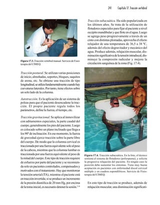 241 Capítulo 17. Tracción vertebral
Tracción postural. Se utilizan varias posiciones
de inicio, almohadas, soportes, bloques, saquitos
de arena, etc. Se obtiene una tracción de tipo
longitudinal,seutilizafundamentalmentecuandohay
curvaturaslaterales.Portanto,tieneefectossobre
un solo lado de la columna.
Autotracción. Es la aplicación de un sistema de
poleas para que el paciente desencadene la trac-
ción. El propio paciente regula todos los
parámetros, define la fuerza, el tiempo, etc.
Tracción gravitacional. Se aplica al inmovilizar
con aditamentos especiales, la parte caudal del
cuerpo,generalmentelospiesdelpaciente.Luego
es colocado sobre un plano inclinado que llega a
los 90º de inclinación. En ese momento, la fuerza
de gravedad ejerce tracción sobre la parte libre
del cuerpo. De modo que la columna cervical es
traccionadaporunafuerzaequivalentesoloalpeso
de la cabeza, mientras que la columna lumbar es
traccionada por una fuerza equivalente al peso de
lamitaddelcuerpo.Estetipodetracciónrequiere
de esfuerzo por parte del paciente y se recomien-
da solo en pacientes controlados, compensados y
motivadosconeltratamiento.Hayquemonitorear
la tensión arterial (TA), mientras el paciente está
entraccióninvertida;siseproduceunincremento
delapresióndiastólicade20mmHg,porencima
delatomainicial,esnecesariodetenerlasesión.5,16
Tracción subacuática. Ha sido popularizada en
los últimos años. Se trata de la utilización de
flotadores especiales para fijar al paciente a nivel
occipitomandibularyquefloteenelagua.Luego
se agrega peso progresivamente a través de un
cinto con distintas plomadas, aprovecha el efecto
relajador de una temperatura de 36,5 a 38 ºC,
además del efecto degravitador y mecánico del
agua. Produce además, relajación muscular, dis-
minuciónsignificativadelatensiónintradiscal,dis-
minuye la compresión radicular y mejora la
circulaciónsanguíneadelazona(Fig.17.4).
En este tipo de tracción se produce, además de
relajación muscular, una disminución significati-
Figura 17.3. Tracción vertebral manual. Servicio de Fisio-
terapia del CIMEQ.
Figura 17.4. Tracción subacuática. En la foto, el técnico
sostiene el sistema de flotadores (poliespuma), y solicita
la progresiva relajación del paciente. En ningún caso la
posición debe aumentar los síntomas. Tiene muy buena
aceptación en pacientes con enfermedad discal cervical
múltiple y en cuadros espondilíticos. Servicio de Fisio-
terapia del CIMEQ.
 