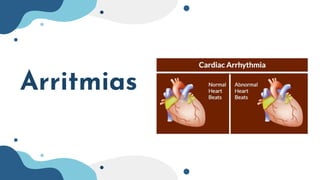 Arritmias
 