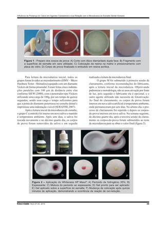 Influência da Presença do Cálcio em Agentes Clareadores e sua Relação com a Microdureza do Esmalte Dental Humano
R bras ci Saúde 14(2):37-44, 2010 39
Para leitura da microdureza inicial, todos os
grupos foram levados ao microdurômetro (HMV – Micro
HardnessTester - Shimadzu) equipado com um diamante
Vickers de forma piramidal. Foram feitas cinco indenta-
ções paralelas com 100 µm de distância entre elas
conforme SIEW (2000), com o penetrador tipo Vickers
utilizando uma carga de 100g, por um tempo de quinze
segundos, sendo essa carga e tempo suficientes para
que a ponta do diamante penetrasse no esmalte dental e
imprimisse uma indentação visível (SERAFIM, 2007).
Após a leitura inicial da microdureza do esmalte,
o grupo C (controle) foi imerso em nova saliva e mantido
à temperatura ambiente. Após sete dias, a saliva foi
trocada novamente e no décimo quarto dia, os corpos
de prova foram removidos da saliva e em seguida
realizada a leitura da microdureza final.
O grupo M foi submetido à primeira sessão de
clareamento, conforme recomendações do fabricante,
após a leitura inicial da microdureza. Objetivando
padronizar a metodologia, não se usou ativação por fonte
de luz, pois segundo o fabricante ela é opcional, e o
outro agente utilizado não necessita de fotoativação.
Ao final do clareamento, os corpos de prova foram
imersos em nova saliva artificial à temperatura ambiente,
onde permaneceram por sete dias. No sétimo dia, o pro-
cesso de clareamento foi repetido e depois os corpos-
de-prova imersos em nova saliva. Na semana seguinte,
do décimo quarto dia, após a terceira sessão de clarea-
mento os corpos-de-prova foram submetidos ao teste
de microdureza para se obter o valor final (figura 2).
Figura 1 - Preparo dos corpos de prova: A) Corte com disco diamantado dupla face; B) Fragmento com
a superfície de esmalte em cera utilidade; C) Colocação da resina na matriz e pressionamento com
placa de vidro; D) Corpo de prova finalizado e embutido em resina acrílica.
Figura 2 – Aplicação do Whiteness HP Maxx®
: A) Peróxido de hidrogênio 35%; B)
Espessante; C) Mistura do peróxido ao espessante; D) Gel pronto para ser aplicado;
E) Gel aplicado sobre a superfície do esmalte; F) Mudança de coloração após quinze
minutos de aplicação, demonstrando a ocorrência da reação de oxi-redução.
 