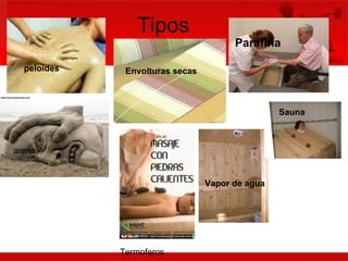 Tipos  peloides arena Envolturas secas Termoferos  Parafina  Vapor de agua Sauna  
