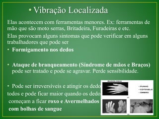 •Vibração Localizada 
Elas acontecem com ferramentas menores. Ex: ferramentas de 
mão que são moto serras, Britadeira, Furadeiras e etc. 
Elas provocam alguns sintomas que pode verificar em alguns 
trabalhadores que pode ser 
• Formigamento nos dedos 
• Ataque de branqueamento (Síndrome de mãos e Braços) 
pode ser tratado e pode se agravar. Perde sensibilidade. 
• Pode ser irreversíveis e atingir os dedo 
todos e pode ficar maior quando os dedos 
começam a ficar roxo e Avermelhados 
com bolhas de sangue 
 