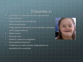 Trissomia 21
Ocorrência: 1 a cada 800 ou 1000 nascimentos
Características:
• Atraso mental leve a moderado
• Olhos amendoados
• Prega palmar transversal única (também conhecida
como prega simiesca)
• Dedos curtos
• Pescoço curto
• Defeitos cardíacos congénitos
• Microcefalia (frequente)
• Problemas na visão (miopia, astigmatismo ou
estrabismo) e na audição
 
