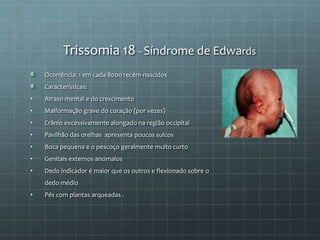 Trissomia 18 - Síndrome de Edwards
Ocorrência: 1 em cada 8000 recém-nascidos
Características:
• Atraso mental e do crescimento
• Malformação grave do coração (por vezes)
• Crânio excessivamente alongado na região occipital
• Pavilhão das orelhas apresenta poucos sulcos
• Boca pequena e o pescoço geralmente muito curto
• Genitais externos anómalos
• Dedo indicador é maior que os outros e flexionado sobre o
dedo médio
• Pés com plantas arqueadas .
 