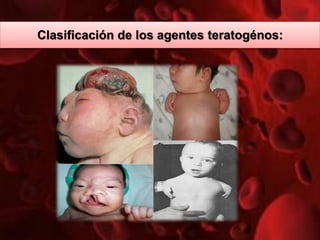 Clasificación de los agentes teratogénos:
 
