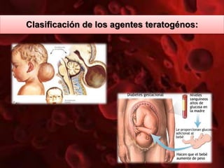 Clasificación de los agentes teratogénos:
 