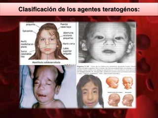 Clasificación de los agentes teratogénos:
 