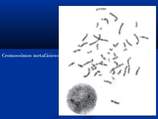 Cromossômos metafásicos
 