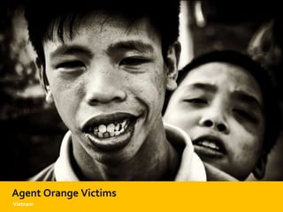 Agent Orange Victims
Vietnam
 