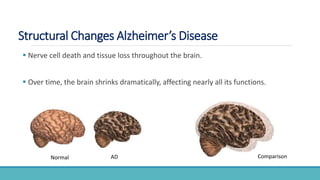 Structural Changes Alzheimer’s Disease
 Nerve cell death and tissue loss throughout the brain.
 Over time, the brain shrinks dramatically, affecting nearly all its functions.
Normal AD Comparison
 