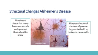 Structural Changes Alzheimer’s Disease
Plaques (abnormal
clusters of protein
fragments) build up
between nerve cells
Alzheimer's
tissue has many
fewer nerve cells
and synapses
than a healthy
brain.
 