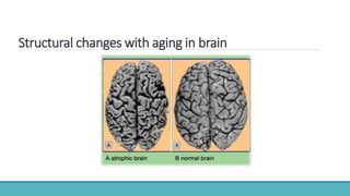 Structural changes with aging in brain
 