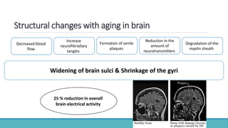Structural changes with aging in brain
Widening of brain sulci & Shrinkage of the gyri
Decreased blood
flow
Increase
neurofibriallary
tangles
Formation of senile
plaques
Reduction in the
amount of
neurotransmitters
Degradation of the
myelin sheath
25 % reduction in overall
brain electrical activity
 
