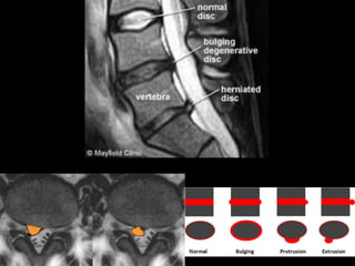Musculoskeletal Health Concerns of the Aging Population | PDF