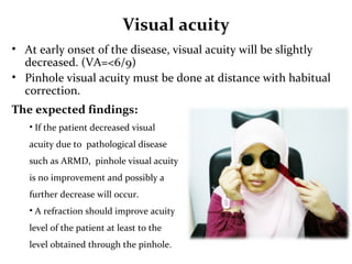 Age related macular degeneration from Optometrist Point of View | PPT