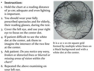 Age related macular degeneration from Optometrist Point of View | PPT