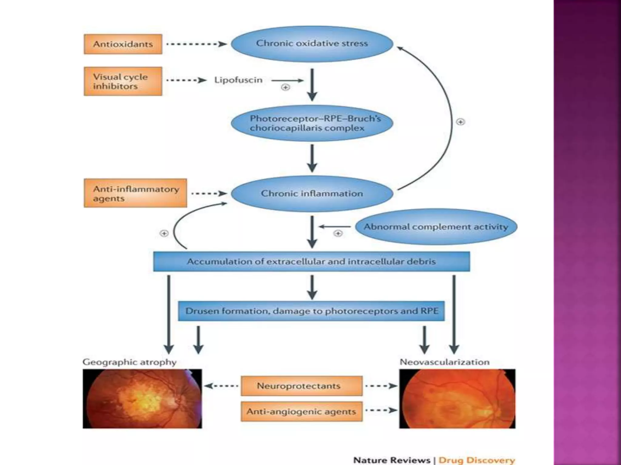 Age related macular degeneration | PPTX