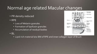 Age related macular degeneration | PPTX