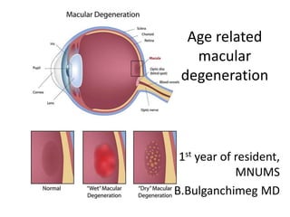 Age related
macular
degeneration
1st year of resident,
MNUMS
B.Bulganchimeg MD
 