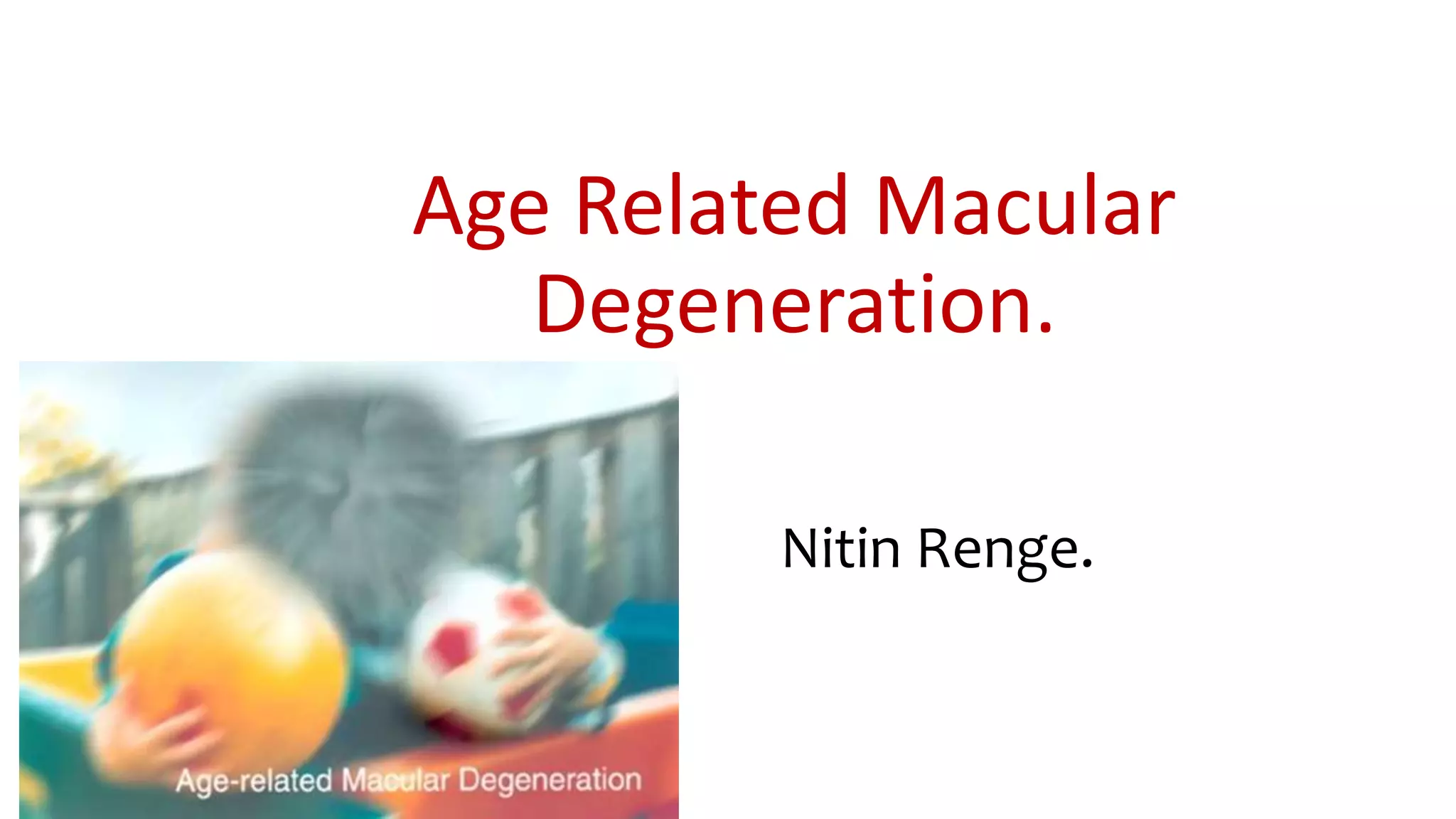 Age related macular degeneration nitin | PPTX