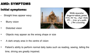 Age related macular degeneration nitin | PPTX