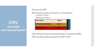 Cnv Types Neovascular AMD | PPTX