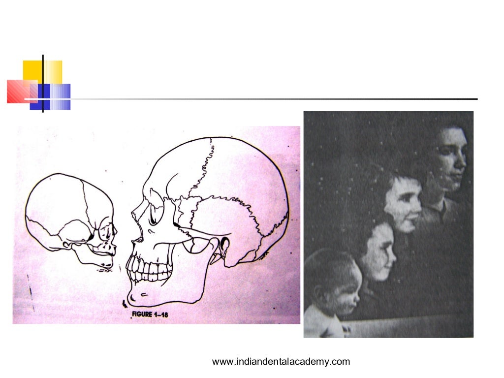 Age related soft tissue changes / orthodontic diploma courses / india…