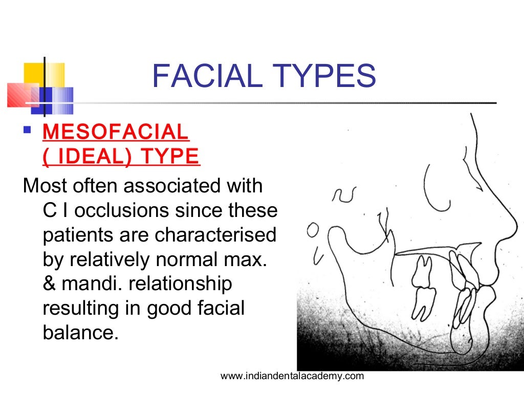 Age related soft tissue changes / orthodontic diploma courses / india…