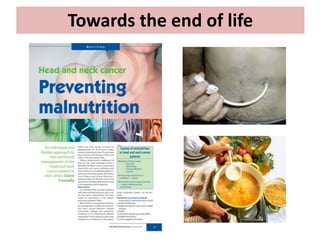 Towards the end of life
 