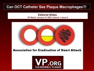 Editorial Slides
VP Watch, January 15, 2003, Volume 1, Issue 2
Can OCT Catheter See Plaque Macrophages?!
 