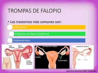 TROMPAS DE FALOPIO 
• Los trastornos más comunes son: 
Infecciones 
Embarazo ectópico (tubárico) 
Endometriosis 
Garnica Alvarez Edith Gabriela 
 